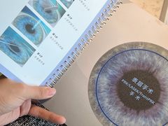 -黑马眼科·近视手术