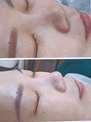 -SKIN79皮肤管理中心