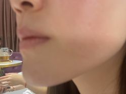 点击看大图 -广州美莱医疗美容医院