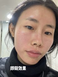 -海峡医疗美容医院