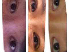 对比图-上海华安整形外科门诊部