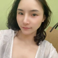 体验后-依萱绮医疗美容