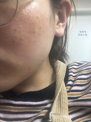 -空军总医院激光整形美容中心