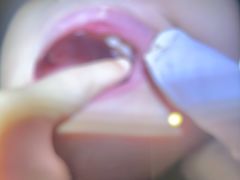 -土豆口腔(凤凰北总店)