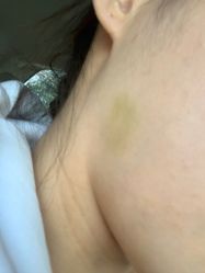 -洁铭新加坡医美