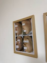 -美肤盾祛痘·问题肌头疗管理中心