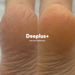 点击看大图 -Deeplus+韩国皮肤管理한국피부관리·C:Lab肌肤实验室