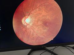 -宝岛眼镜(常熟珠江路欧尚店)