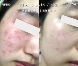 -KISS U 国际美学