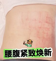 点击看大图 -Lily纤美·科技减脂中心