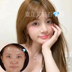 -北京米扬丽格医疗美容·联合丽格鼻整形中心