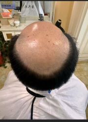 -唐风采假发补发定制