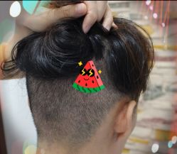 -大麦微针植发全国连锁