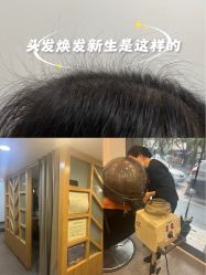 -章光101防脱养发荟