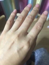 -薇兰专业脱毛连锁机构