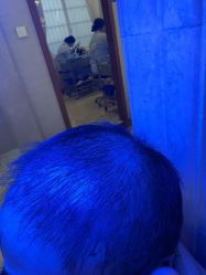 -碧莲盛·不剃发植发