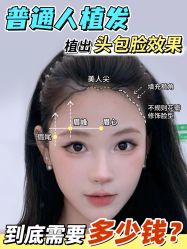 -大麦微针植发丨全国连锁