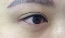 韩式隐形眼线-平萍纹绣韩式半永久定妆