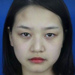 点击看大图 体验前-烟台曙光医疗美容医院
