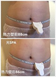 光SPA热力塑瘦身-光SPA科技美肤