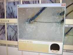 -LESSMORE科技头皮理容中心