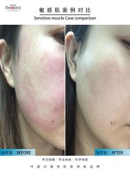 -黎蓓露·徒手骨雕蛋白抗衰·调肤管理