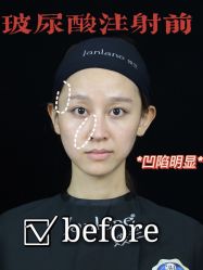 -广州美莱医疗美容医院