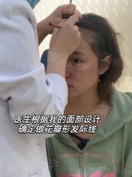 -雍禾植发全国连锁