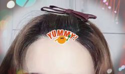 -大麦微针植发全国连锁