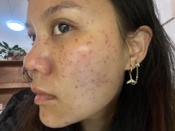 体验后-云南吴氏嘉美医疗美容医院