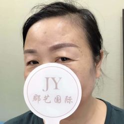 点击看大图 -郡艺医疗美容·微整·眼鼻吸脂