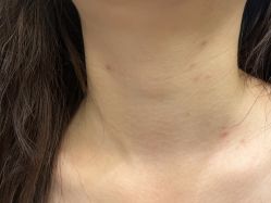 -美瑞莎创美医疗美容