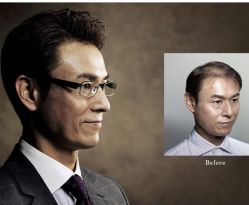 -发饰美男士增发补发假发定制店