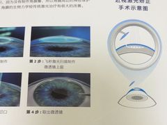 -昆明普瑞眼科医院·近视手术(龙泉院区)