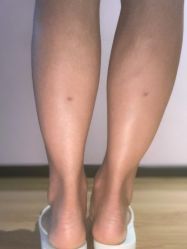 点击看大图 体验前-昆明梦想医疗美容医院