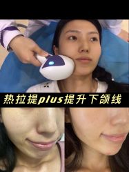 -西安壹加壹医疗美容·西北抗衰旗舰店