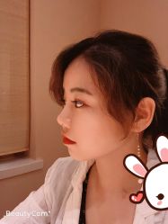 点击看大图 -大麦微针植发丨全国连锁