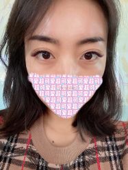 体验后-北京楚诺医疗美容
