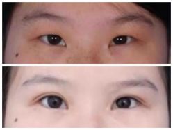 体验前-厦门美莱整形美容医院