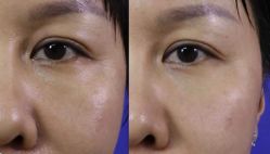 -云南吴氏嘉美医疗美容医院