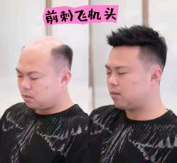 -唐风采假发补发定制
