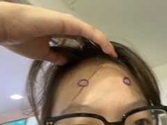 -武汉大学附属爱尔眼科医院(湖北总院)