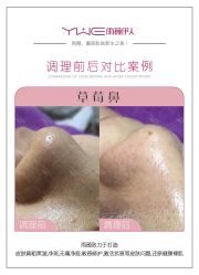 -元熙兰积皮肤管理