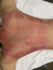 -CICI纤美·科技减肥美容