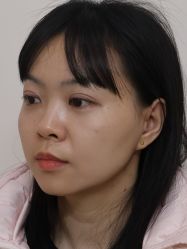 -广州健丽·去眼袋医疗美容机构