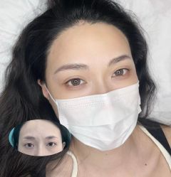 -杨益美学·野生眉半永久纹眉发际线