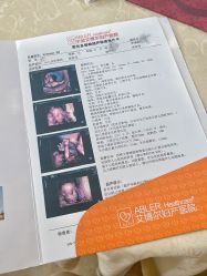 -艾博尔医院