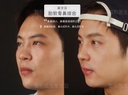 -北京米扬丽格医疗美容·联合丽格鼻整形中心