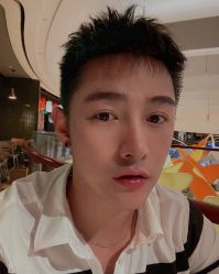 体验后-大麦微针植发全国连锁