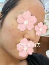体验前-深圳美莱医疗美容医院